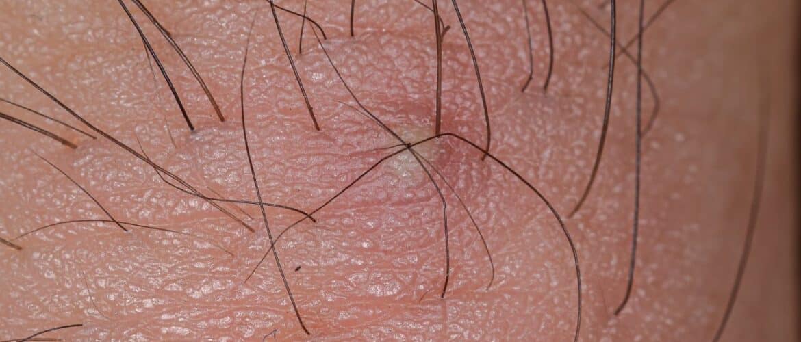 post-wax care products